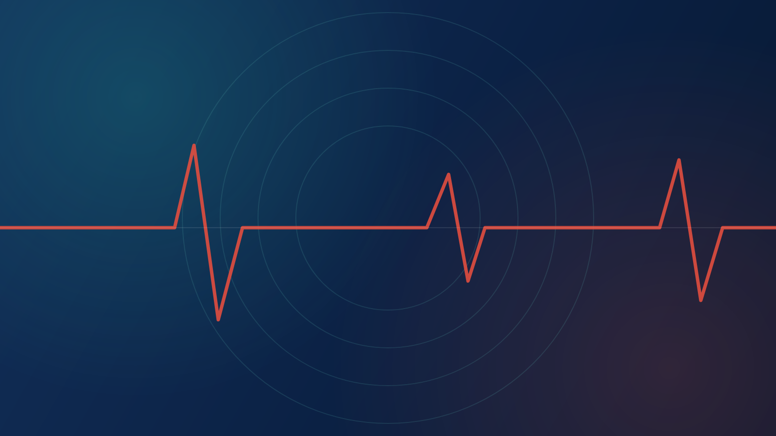 Aperçu de la vidéo « Comment fonctionne l'assistance cardiaque »